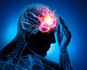 Concussion Injury
