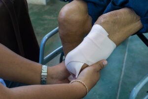 What Causes an Amputation Injury?