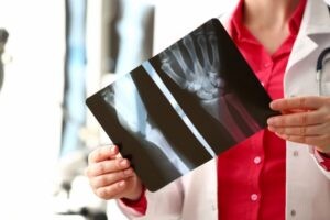Common Types of Car Accident Injuries