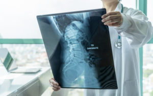 Signs That You’ve Broken a Bone