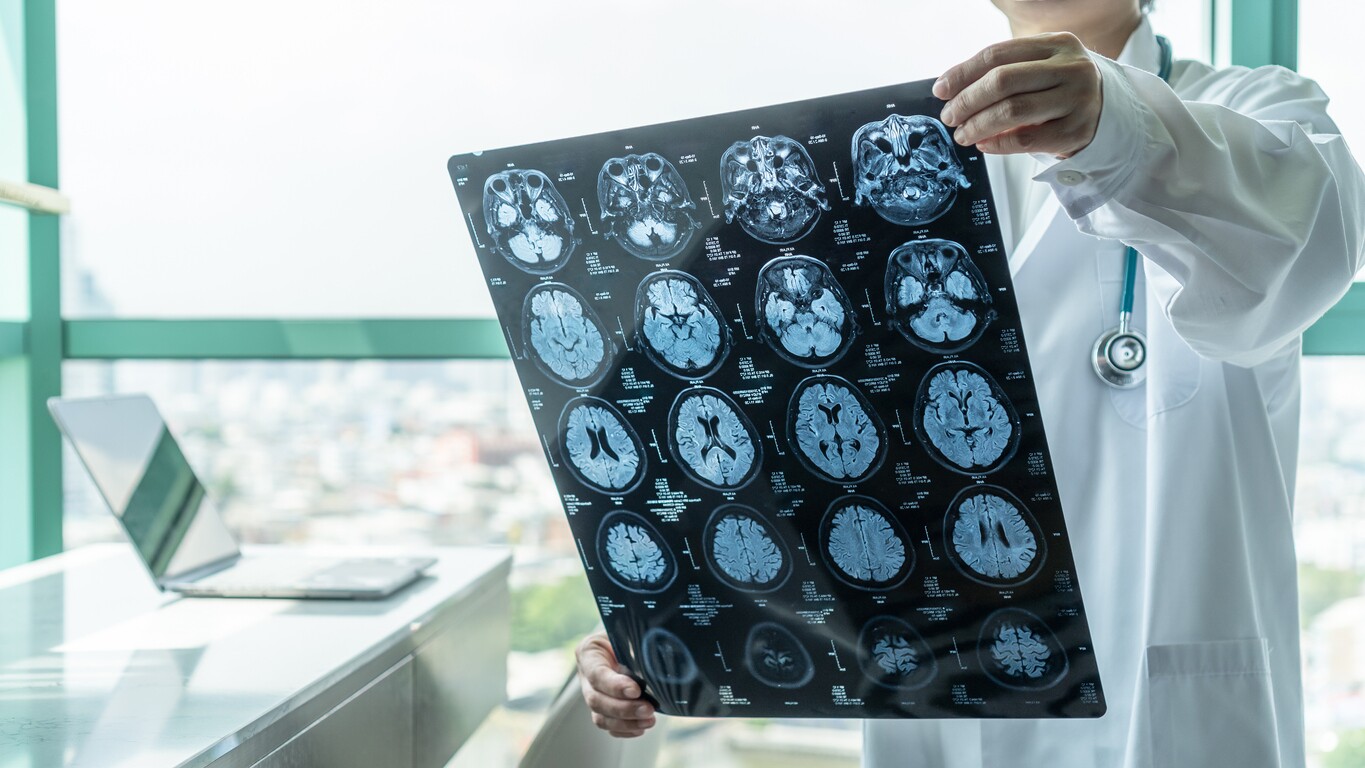 Traumatic Brain Injury Symptoms Years Later