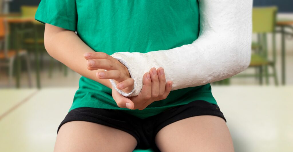 A child wearing a full arm cast after an accident leading to a Tampa Personal Injury claim.